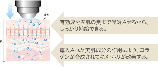 有効成分を肌の奥まで浸透させるから、しっかり補給できる。 導入された美肌成分の作用により、コラーゲンが合成されてキメ・ハリが改善する。