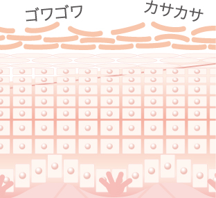 ゴワゴワ カサカサ