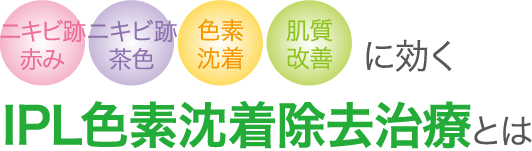 ニキビ跡赤みニキビ跡茶色色素沈着肌質改善に効くIPL色素沈着除去治療とは