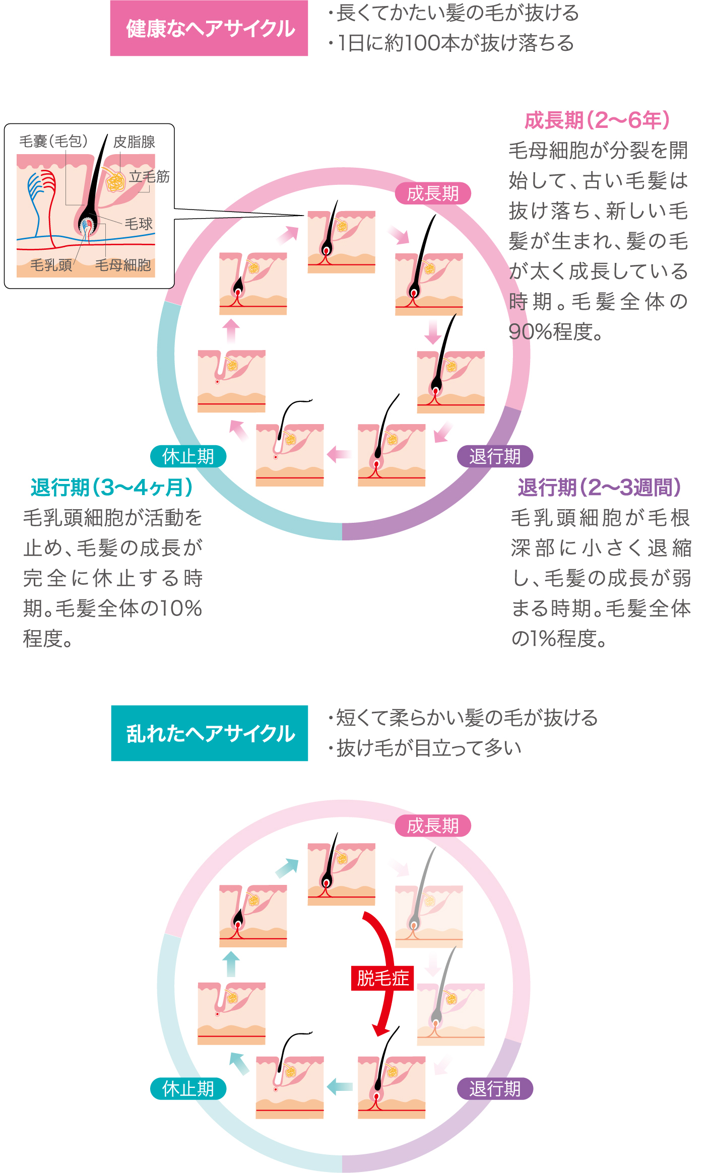 ヘアサイクルの乱れが薄毛を招きます