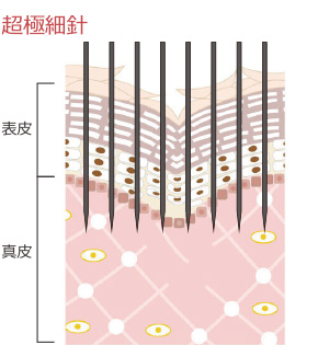 治療